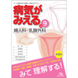 病気がみえる　vol.9　婦人科・乳腺外科　第4版 [BY9-4]