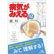 医療共通（みえるシリーズ等）/病気がみえる　vol.12　眼科　第1版