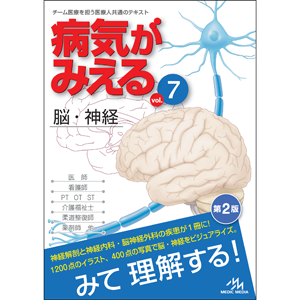 病気がみえる　vol.7　脳・神経　第2版 [BY7-2]