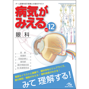 病気がみえる　vol.12　眼科　第1版(BY12-1)