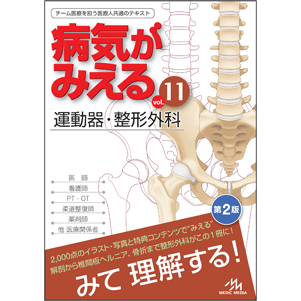 病気がみえる　vol.11　運動器・整形外科　第2版 [BY11-2]