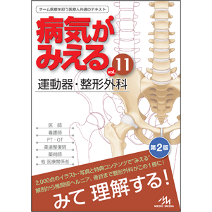 病気がみえる vol.11 運動器・整形外科 第2版【MEDICMEDIA WEBSHOP】