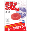 書籍/病気がみえる　vol.5　血液　第2版