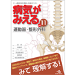書籍/病気がみえる　vol.11　運動器・整形外科　第1版