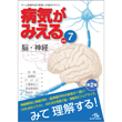 /病気がみえる　vol.7　脳・神経　第2版