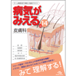 書籍/病気がみえる　vol.14　皮膚科　第1版